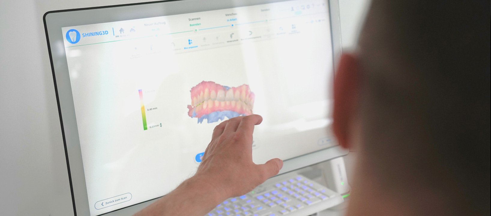 Intraoralscanner2 - Zahnwerk Rehbein